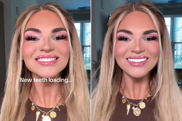 Bay Stone with her new veneers.