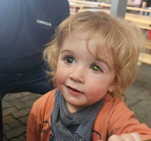 Toddler’s